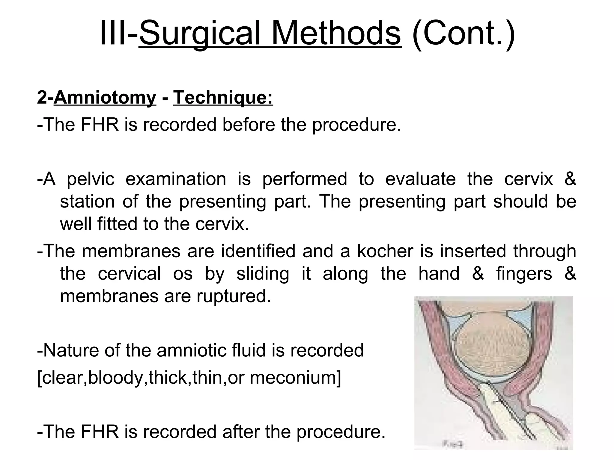 III-Surgical Methods (Cont.)
2-Amniotomy - Technique:
-The FHR is recorded before the procedure.
-A pelvic examination is performed to evaluate the cervix &
station of the presenting part. The presenting part should be
well fitted to the cervix.
-The membranes are identified and a kocher is inserted through
the cervical os by sliding it along the hand & fingers &
membranes are ruptured.
-Nature of the amniotic fluid is recorded
[clear,bloody,thick,thin,or meconium]
-The FHR is recorded after the procedure.

 
