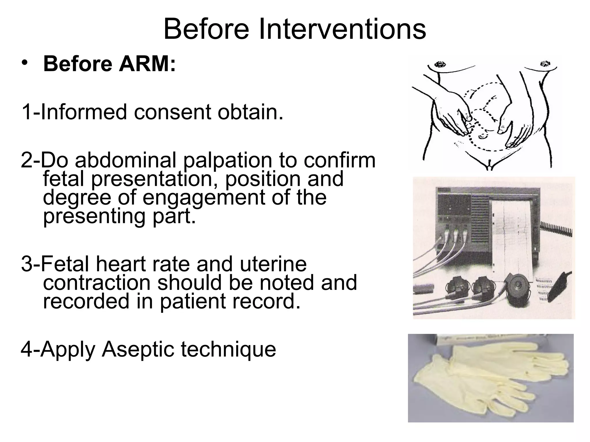 Before Interventions
• Before ARM:
1-Informed consent obtain.
2-Do abdominal palpation to confirm
fetal presentation, position and
degree of engagement of the
presenting part.
3-Fetal heart rate and uterine
contraction should be noted and
recorded in patient record.
4-Apply Aseptic technique

 