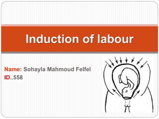 Name: Sohayla Mahmoud Felfel
ID..558
Induction of labour
 