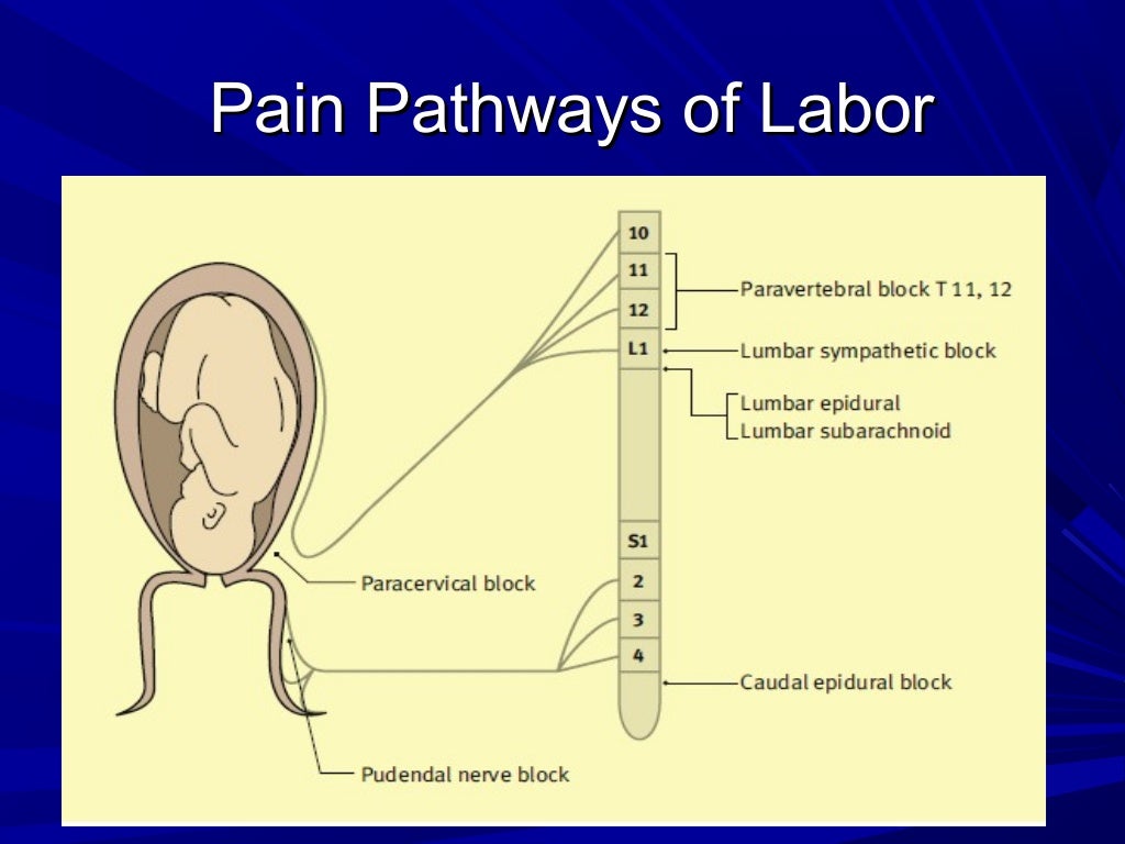 Induction of labor& pain reief inlabor for undergraduate