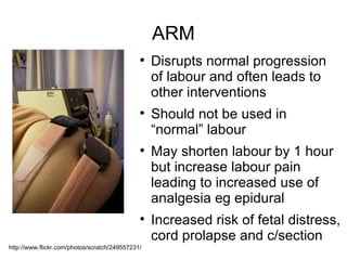 Induction of labour and artificial rupture of membranes | PPT