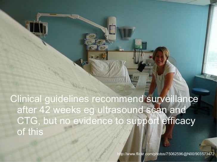 Induction of labour and artificial rupture of membranes