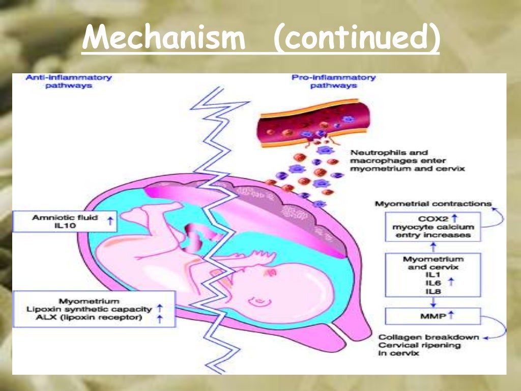 Induction of labour