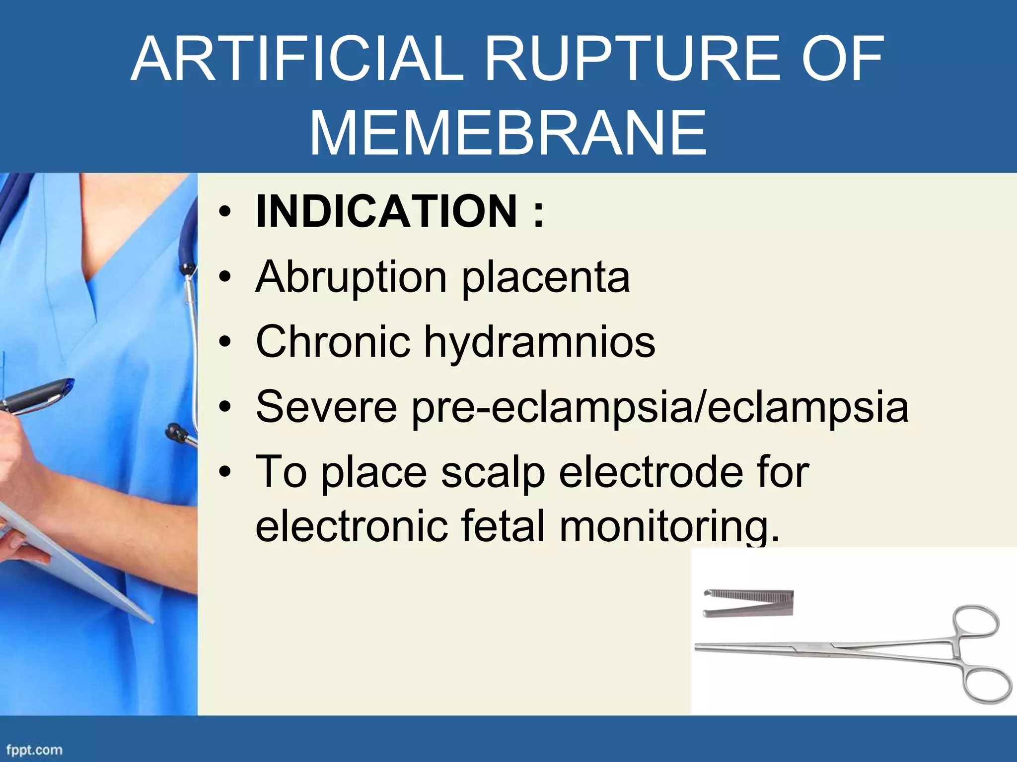 Arm Induction Induction of labour | PPTX