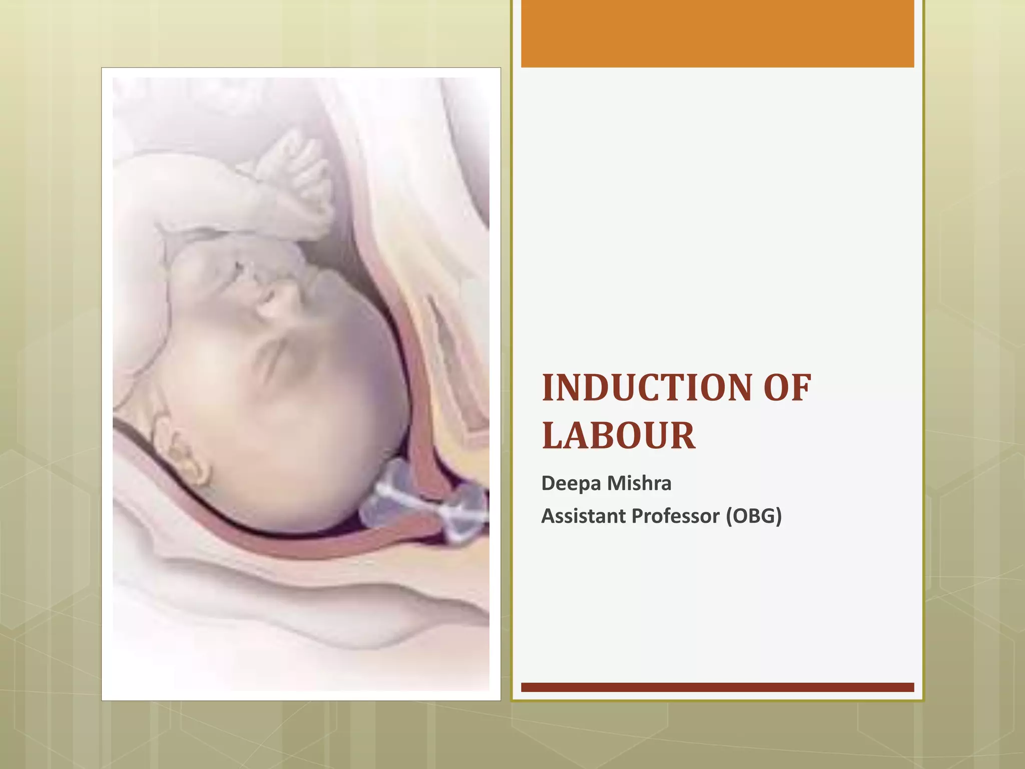 Labour Lesson Induction of labour | PPTX