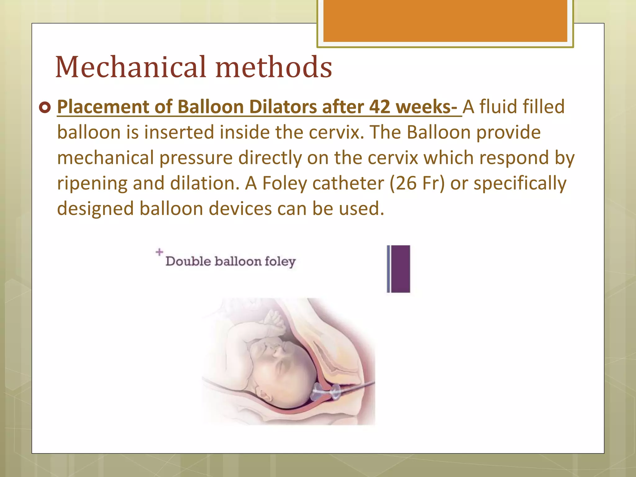 Induction of labour | PPTX