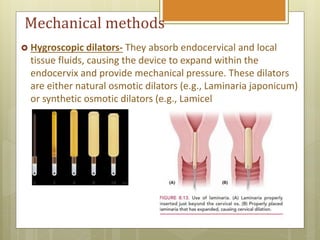 Induction of labour | PPTX