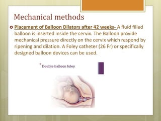 Induction of labour | PPTX