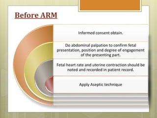 Arm Induction Induction of labour | PPTX