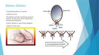Labor Balloon Example induction and augmentation of labour.pptx