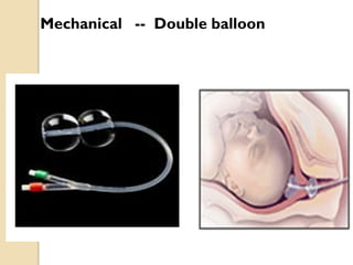 Induction of labour (2) | PPTX