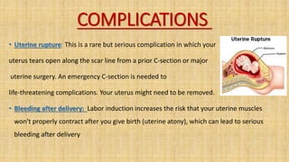 COMPLICATIONS
• Uterine rupture: This is a rare but serious complication in which your
uterus tears open along the scar line from a prior C-section or major
uterine surgery. An emergency C-section is needed to
life-threatening complications. Your uterus might need to be removed.
• Bleeding after delivery: Labor induction increases the risk that your uterine muscles
won't properly contract after you give birth (uterine atony), which can lead to serious
bleeding after delivery
 