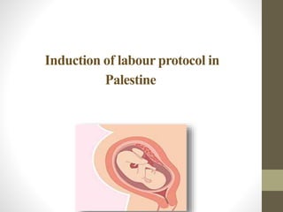 Induction of labour protocol in
Palestine
 