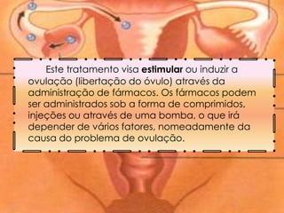 Este tratamento visa estimular ou induzir a
ovulação (libertação do óvulo) através da
administração de fármacos. Os fármacos podem
ser administrados sob a forma de comprimidos,
injeções ou através de uma bomba, o que irá
depender de vários fatores, nomeadamente da
causa do problema de ovulação.
 