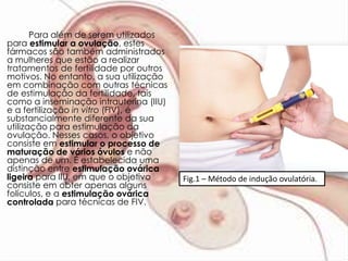 Para além de serem utilizados
para estimular a ovulação, estes
fármacos são também administrados
a mulheres que estão a realizar
tratamentos de fertilidade por outros
motivos. No entanto, a sua utilização
em combinação com outras técnicas
de estimulação da fertilidade, tais
como a inseminação intrauterina (IIU)
e a fertilização in vitro (FIV), é
substancialmente diferente da sua
utilização para estimulação da
ovulação. Nesses casos, o objetivo
consiste em estimular o processo de
maturação de vários óvulos e não
apenas de um. É estabelecida uma
distinção entre estimulação ovárica
ligeira para IIU, em que o objetivo     Fig.1 – Método de indução ovulatória.
consiste em obter apenas alguns
folículos, e a estimulação ovárica
controlada para técnicas de FIV.
 