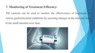 induja _PPT[1]. pill camera in medicine | PPTX