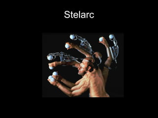 Stelarc 