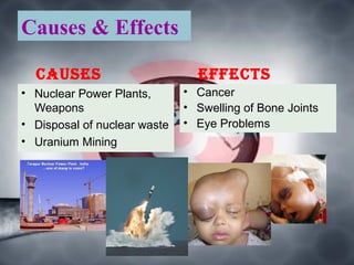 Causes & Effects
Causes
• Nuclear Power Plants,
Weapons
• Disposal of nuclear waste
• Uranium Mining
effeCts
• Cancer
• Swelling of Bone Joints
• Eye Problems
 