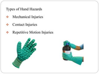 Types of Hand Hazards
 Mechanical Injuries
 Contact Injuries
 Repetitive Motion Injuries
 