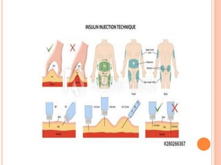 Inectables of diabetes | PPTX