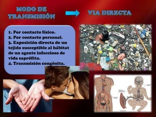 1. Por contacto físico.
2. Por contacto personal.
3. Exposición directa de un
tejido susceptible al hábitat
de un agente infeccioso de
vida saprófita.
4. Transmisión congénita.