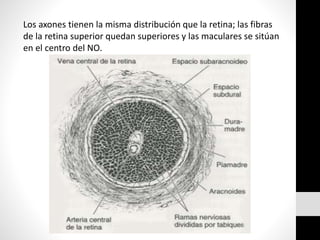 Los axones tienen la misma distribución que la retina; las fibras
de la retina superior quedan superiores y las maculares se sitúan
en el centro del NO.
 