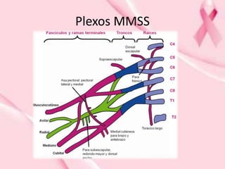 Plexos MMSS
 