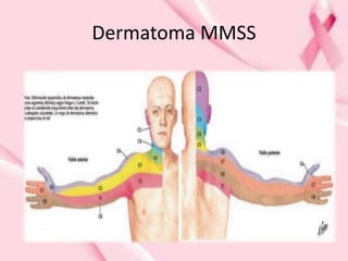 Dermatoma MMSS
 