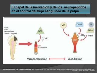 El papel de la inervación y de los neuropéptidos
                en el control del flujo sanguíneo de la pulpa.




Neuropeptides in Dental Pulp: The Silent Protagonists. Javier Caviedes-Bucheli, DDS, MSc, Hugo Roberto Muñoz, DDS, MSc, María Mercedes Azuero-Holguín, DDS, and Esteban Ulate,
                                                                                                                                   DDS JOE — Volume 34, Number 7, July 2008
 