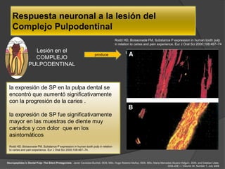 Respuesta neuronal a la lesión del
    Complejo Pulpodentinal
                                                                                        Rodd HD, Boissonade FM. Substance P expression in human tooth pulp
                                                                                        in relation to caries and pain experience. Eur J Oral Sci 2000;108:467–74

                   Lesión en el                                                                  numerosas las respuestas
                                                                       produce
                   COMPLEJO                                                                            neuronales
                 PULPODENTINAL



 la expresión de SP en la pulpa dental se                                                               NEUROPEPTIDOS
 encontró que aumentó significativamente
 con la progresión de la caries .

 la expresión de SP fue significativamente                                                              también regulan la
 mayor en las muestras de diente muy                                                                 respuesta a daños en los
 cariados y con dolor que en los                                                                         tejidos periféricos
 asintomáticos
 Rodd HD, Boissonade FM. Substance P expression in human tooth pulp in relation
 to caries and pain experience. Eur J Oral Sci 2000;108:467–74.



Neuropeptides in Dental Pulp: The Silent Protagonists. Javier Caviedes-Bucheli, DDS, MSc, Hugo Roberto Muñoz, DDS, MSc, María Mercedes Azuero-Holguín, DDS, and Esteban Ulate,
                                                                                                                                   DDS JOE — Volume 34, Number 7, July 2008
 