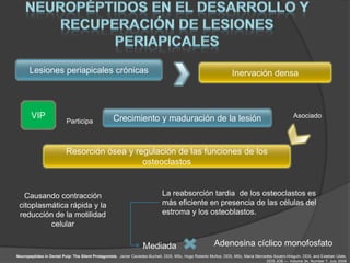 Lesiones periapicales crónicas                                                                             Inervación densa



       VIP                                         Crecimiento y maduración de la lesión                                                          Asociado
                          Participa



                          Resorción ósea y regulación de las funciones de los
                                             osteoclastos


   Causando contracción                                                     La reabsorción tardia de los osteoclastos es
 citoplasmática rápida y la                                                 más eficiente en presencia de las células del
 reducción de la motilidad                                                  estroma y los osteoblastos.
          celular

                                                                  Mediada                               Adenosina cíclico monofosfato
Neuropeptides in Dental Pulp: The Silent Protagonists. Javier Caviedes-Bucheli, DDS, MSc, Hugo Roberto Muñoz, DDS, MSc, María Mercedes Azuero-Holguín, DDS, and Esteban Ulate,
                                                                                                                                   DDS JOE — Volume 34, Number 7, July 2008
 