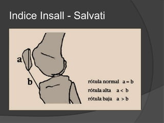 Indice Insall - Salvati 
 