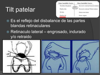 Tilt patelar 
 Es el reflejo del disbalance de las partes 
blandas retinaculares 
 Retinaculo lateral – engrosado, indurado 
y/o retraido 
 