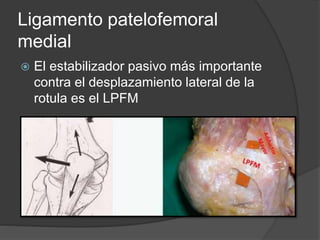 Ligamento patelofemoral 
medial 
 El estabilizador pasivo más importante 
contra el desplazamiento lateral de la 
rotula es el LPFM 
 