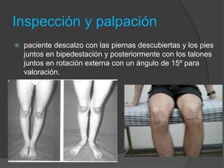 Inspección y palpación 
 paciente descalzo con las piernas descubiertas y los pies 
juntos en bipedestación y posteriormente con los talones 
juntos en rotación externa con un ángulo de 15º para 
valoración. 
 