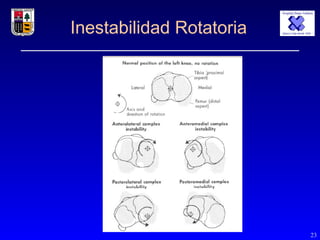 Rotular Instability presentacion de INESTABILIDAD de RODILLA | PPT