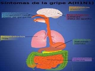 H1N1