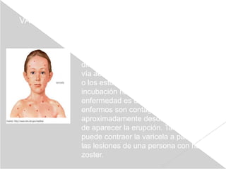 VARICELA   La varicela puede verse en cualquier
           época del año, aunque es más
           frecuente en el invierno y la primavera.
           El virus causante sólo se transmite de
           persona a persona, ya sea por contacto
           directo con las lesiones cutáneas o por
           vía aérea al expulsarse mediante la tos
           o los estornudos. El periodo de
           incubación hasta que aparece la
           enfermedad es de 2 a 3 semanas. Los
           enfermos son contagiosos
           aproximadamente desde 2 días antes
           de aparecer la erupción. También se
           puede contraer la varicela a partir de
           las lesiones de una persona con herpes
           zoster.
 
