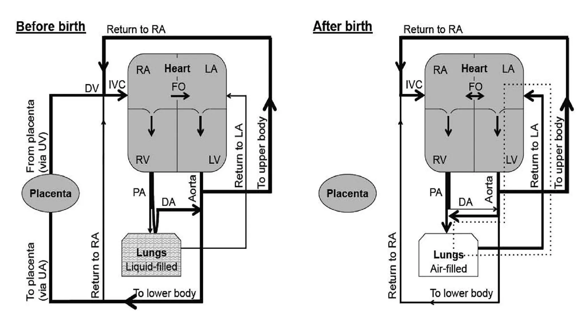 physiological changes in infancy and after birth | PPTX