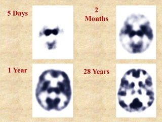 5 Days 2
Months
1 Year 28 Years
 