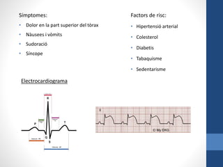 Factors de risc:
• Hipertensió arterial
• Colesterol
• Diabetis
• Tabaquisme
• Sedentarisme
Símptomes:
• Dolor en la part superior del tòrax
• Nàusees i vòmits
• Sudoració
• Síncope
Electrocardiograma
 