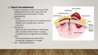 Infant deaths fmt powerpoint presentation. | PPTX