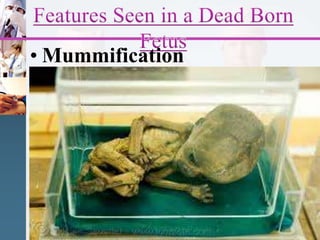 • Mummification
 