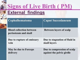 Signs of Live Birth ( PM)
External findings
Cephalhematoma Caput Succedaneum
Blood collection between
periosteum and skull
Between layers of scalp
Due to rupture of emissary
vein
Due to stagnation of fluid in
skull layers
May be due to Forceps
delivery
Due to compression of scalp
against the pelvic girdle
 