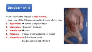 Deadborn child
• One in which the foetus has died in-utero,
• shows one of the following signs after it is completely born
1. Rigor mortis  normal change of death
2. Maceration no air in the liquor
3. Putrefaction air ++
4. Adipocere liquor amnii is retained for longer
5. Mummificationif all liquor amnii
has been absoarbed /drained
 