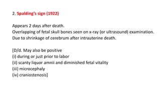 2. Spalding’s sign (1922)
Appears 2 days after death.
Overlapping of fetal skull bones seen on x-ray (or ultrasound) examination.
Due to shrinkage of cerebrum after intrauterine death.
[D/d. May also be positive
(i) during or just prior to labor
(ii) scanty liquor amnii and diminished fetal vitality
(iii) microcephaly
(iv) craniostenosis]
 