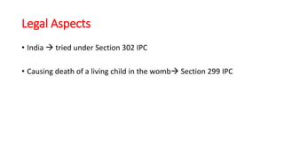 Legal Aspects
• India  tried under Section 302 IPC
• Causing death of a living child in the womb Section 299 IPC
 