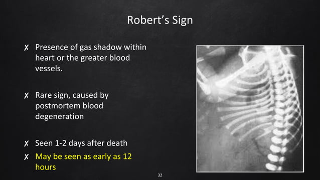 Infanticide -converted.pdf