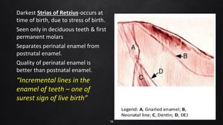 Tooth Retzius Infanticide -converted_241031_052405.pdf