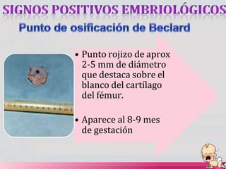 • Punto rojizo de aprox
2-5 mm de diámetro
que destaca sobre el
blanco del cartílago
del fémur.
• Aparece al 8-9 mes
de gestación
 